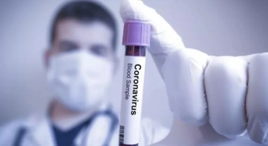 xtest-coronavirus-g.jpg.pagespeed.ic_.qkk8s0rfu5.jpg